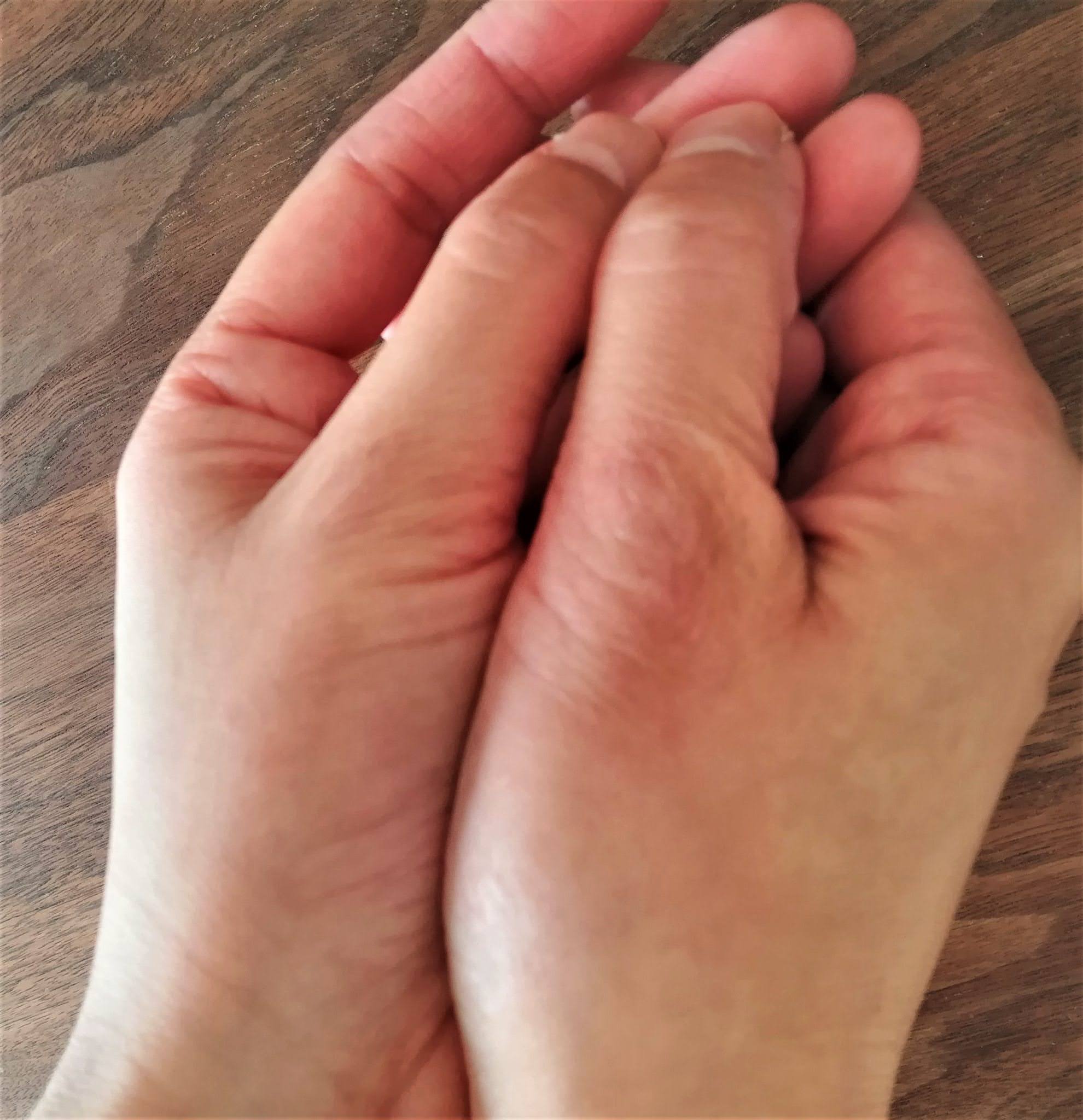 After：施術後の状態