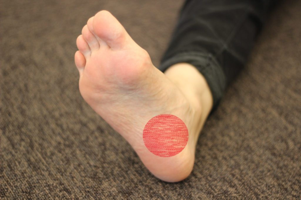 足底筋膜炎マッサージビデオ