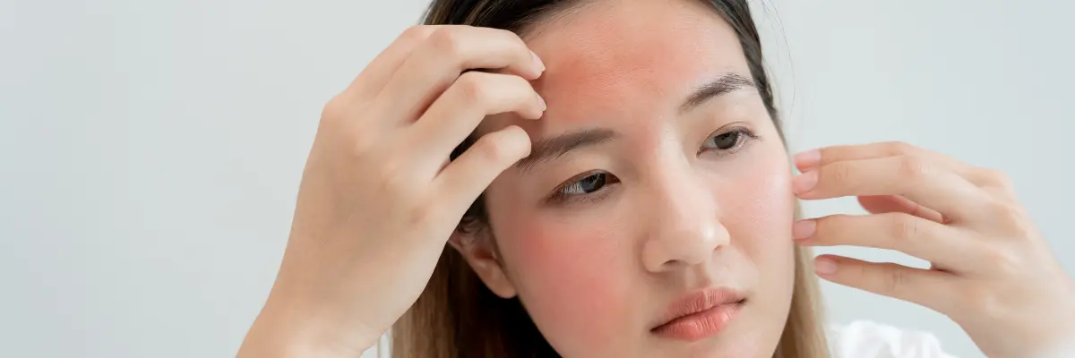 日光アレルギーにより顔の赤みやかゆみに悩む女性のイメージ画像